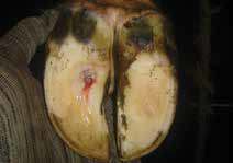 Sole Ulcer Example